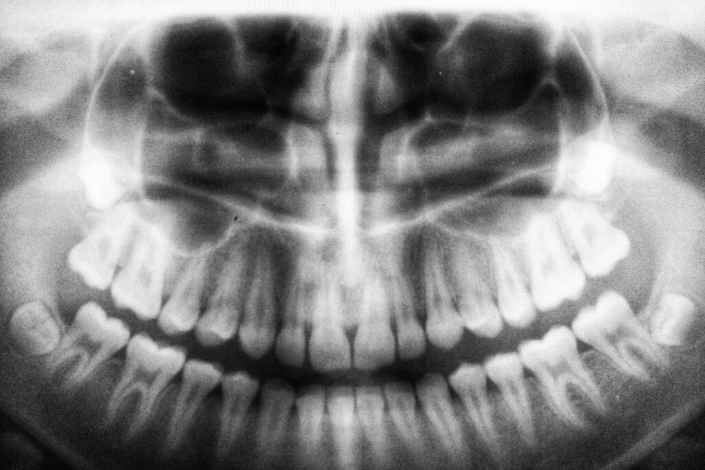 Denti del giudizio, 1982